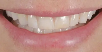 Before Image