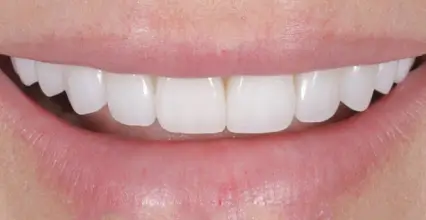 After Image