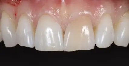 Before Image