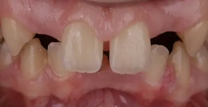 Before Image
