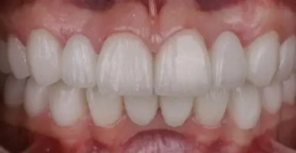 After Image