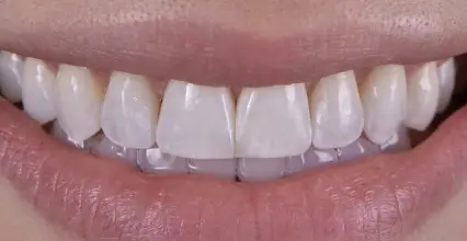 Before Image