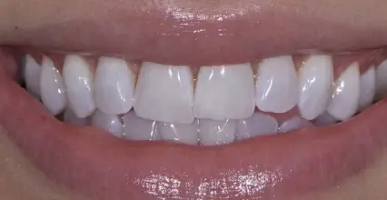 After Image