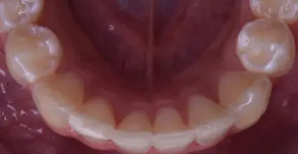 After Image