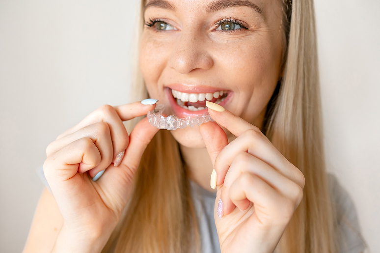 Clear Aligners