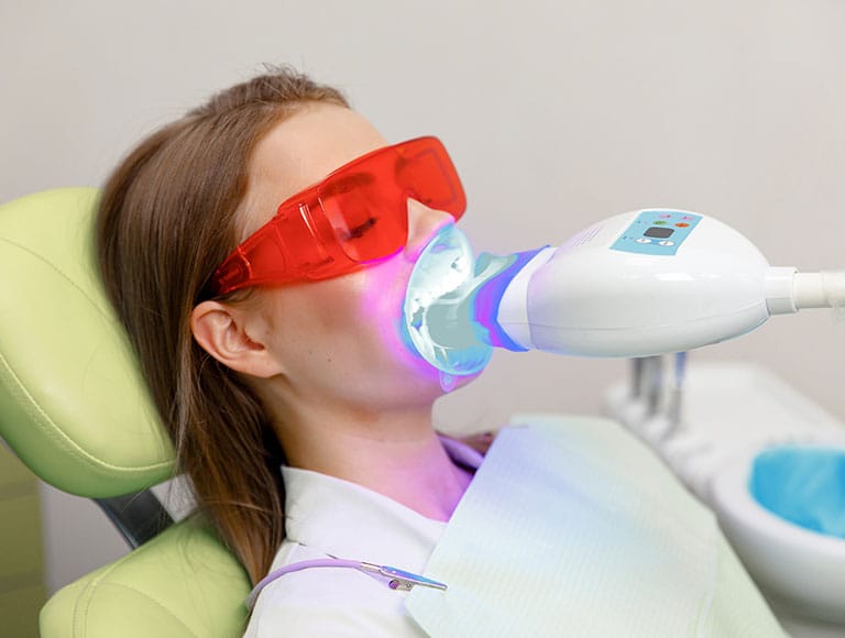Teeth Whitening — 123 iSmile Modesto CA