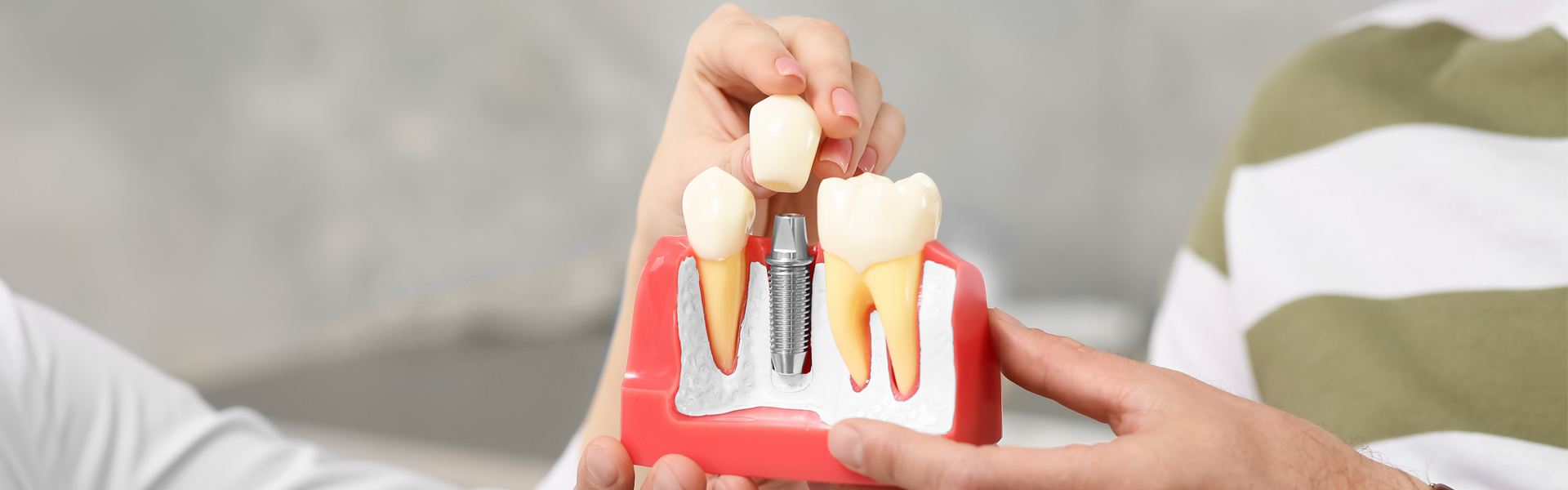 Biting the Bullet: Dealing with Dental Implant Pain When Chewing